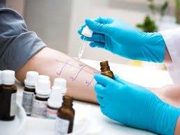 Skin Prick Allergy Testing